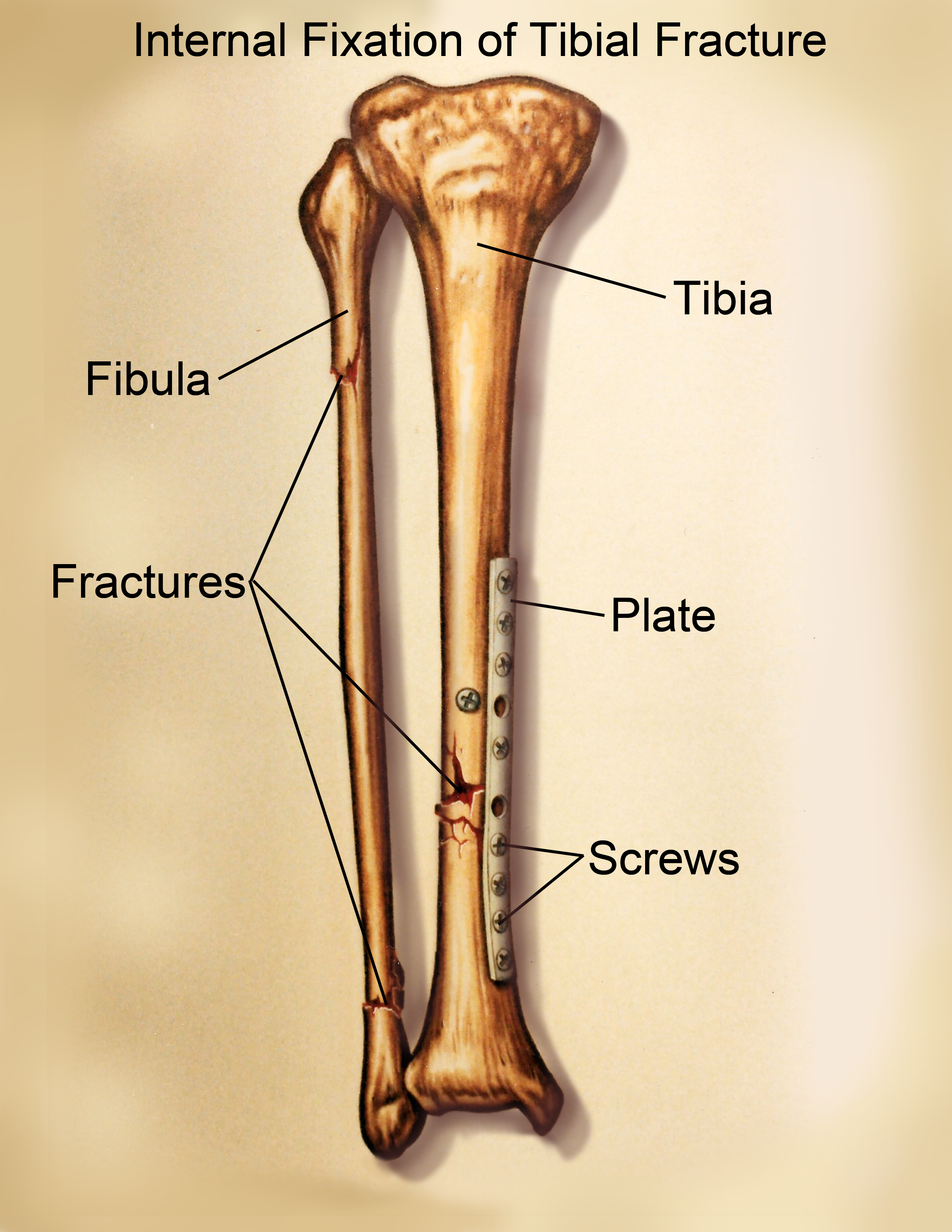 Tibia